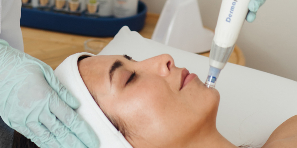 Lady lying on bed receiving a Dermapen treatment from therapist