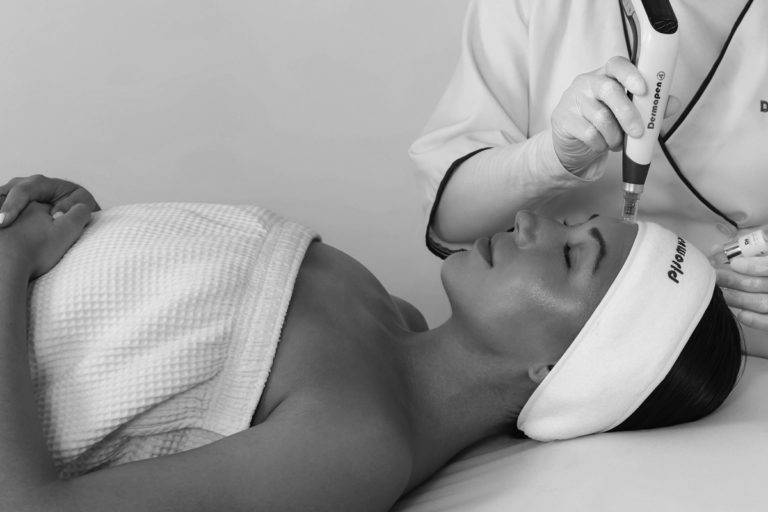 Dermapen 4 Promo 56 1200x800px 1 2 768x512