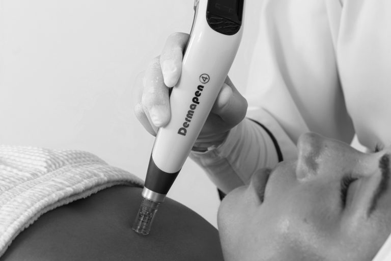 Dermapen 4 Promo 59 3755x5632px 768x512
