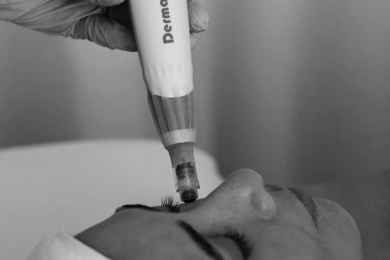 Dermapen 4 Promo 6 1080x1920px 2 768x512