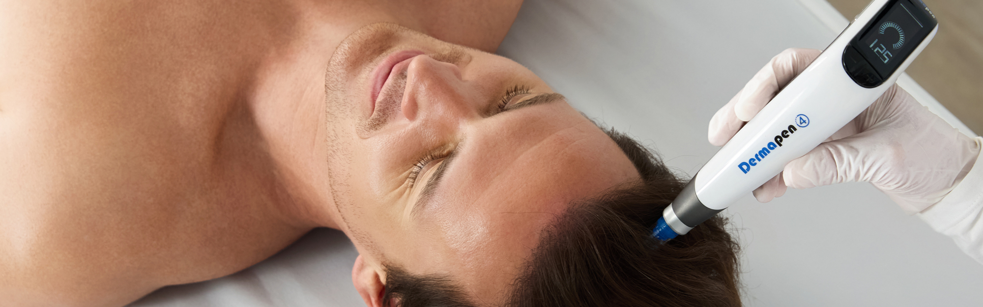 Male receiving Dermapen Exo-Grow Microneedling Treatment on head