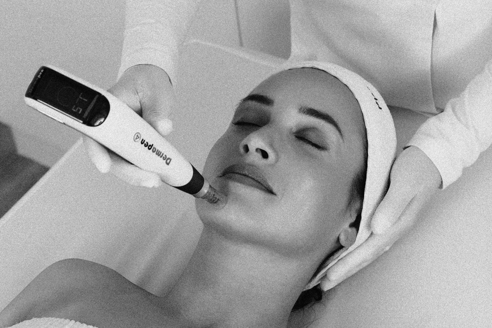 Lady receiving a Dermapen 4 treatment