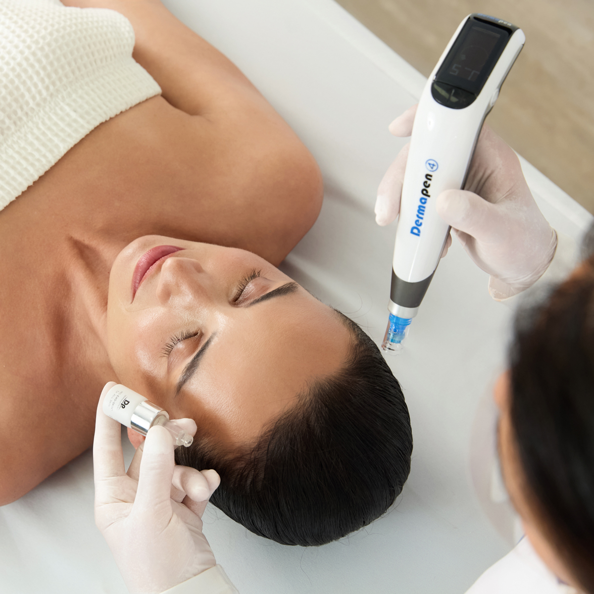 Lady receiving a Dermapen Microneedling Treatment with EXO-SKIN