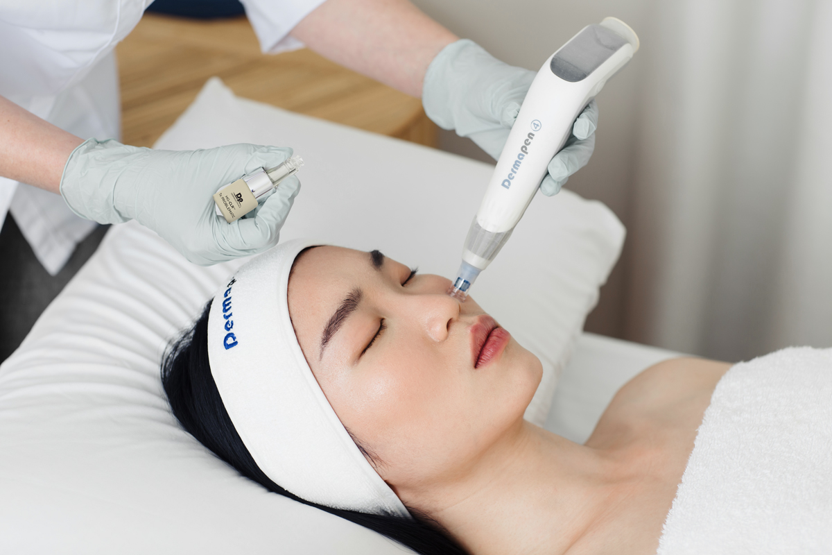 Lady lying on bed receiving a Dermapen4 treatment on face