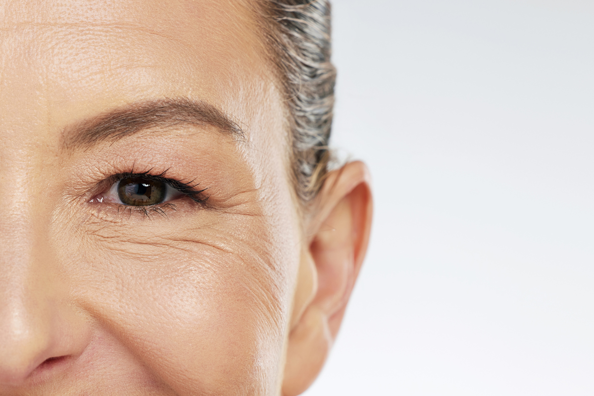 Woman with fine lines & wrinkles