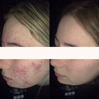 NEUROCOSMEDICS Cameo Skin Body Beauty