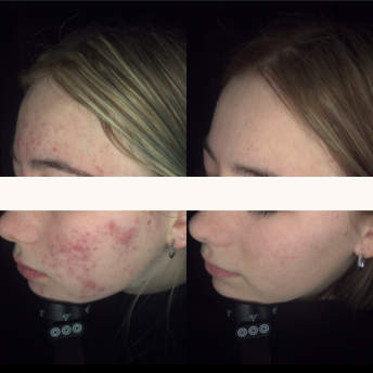 NEUROCOSMEDICS Cameo Skin Body Beauty