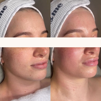 NEUROCOSMEDICS Molly's Beauty Ballarat