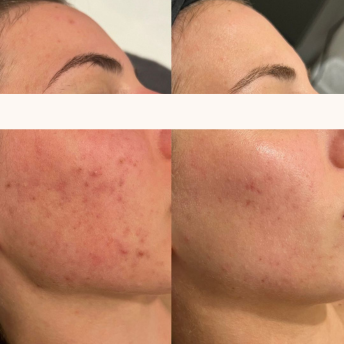 NEUROCOSMEDICS Rejuvenate You Beauty