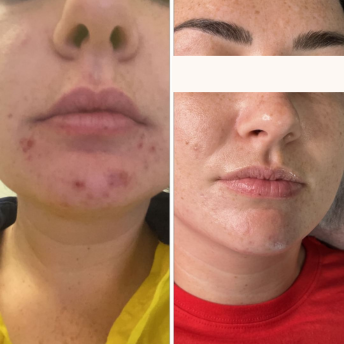 NEUROCOSMEDICS Skin Clair Beauty Room