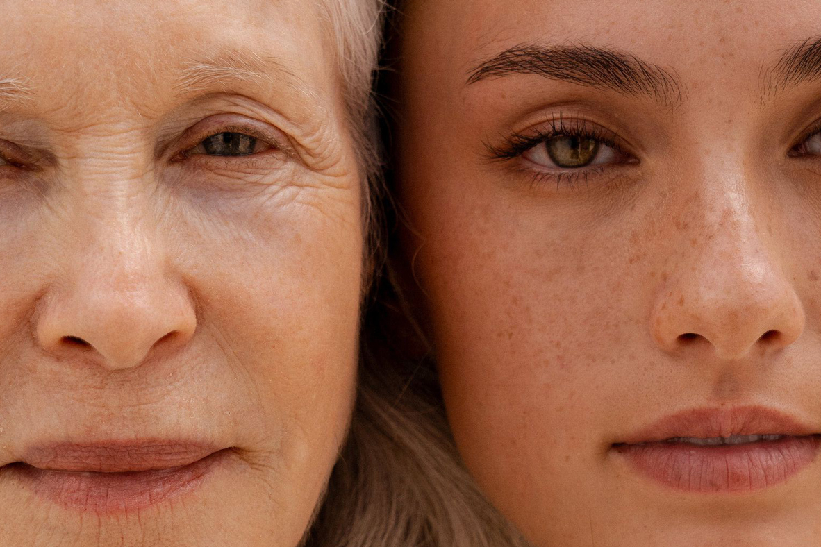 Close up of two ladies faces skin.