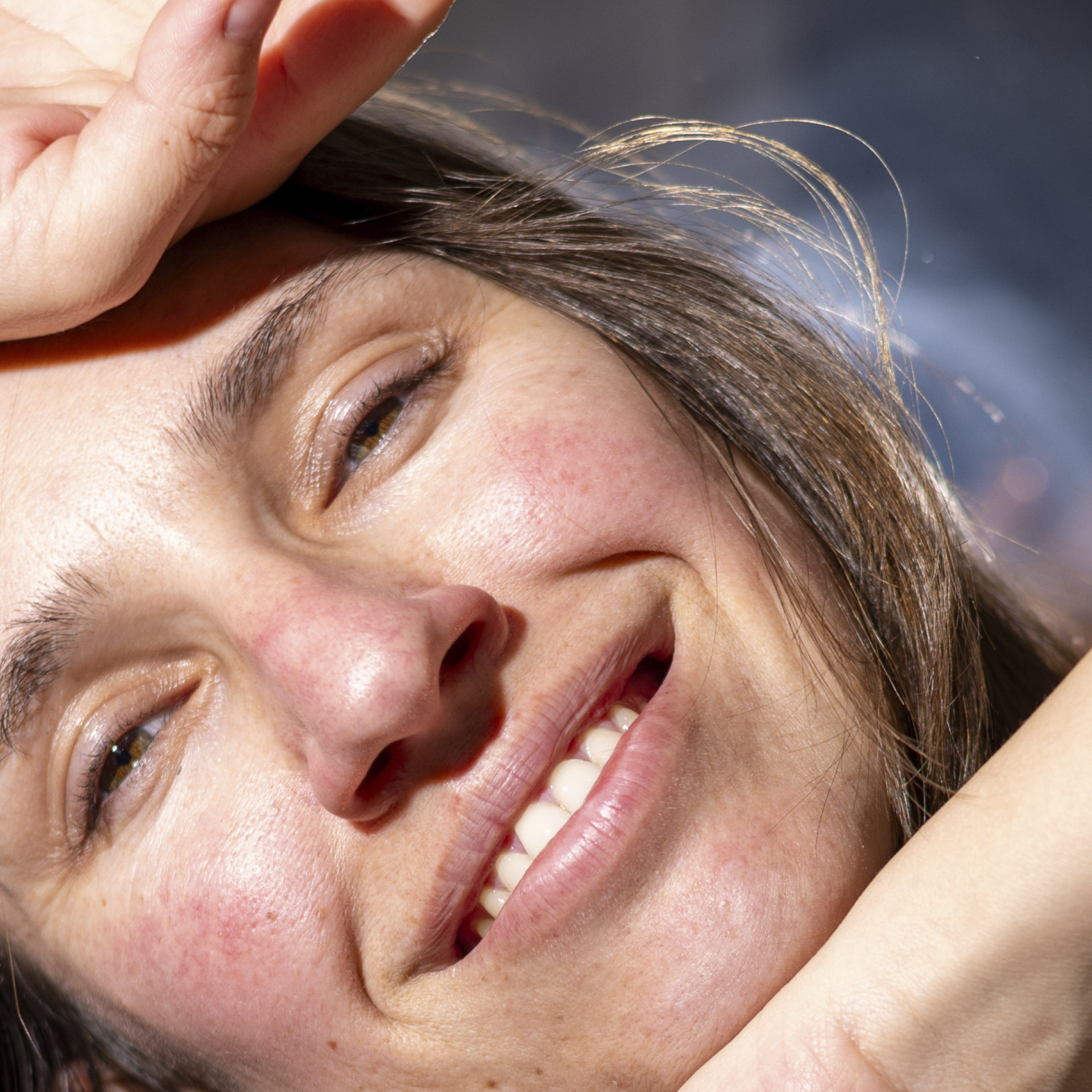 woman smiling with redness and rosacea on her face